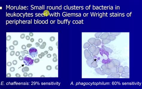 10 Rickettsia Coxiella Ehrlichia And Bartonella Bacterial Rashes