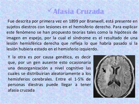 Afasias Neuropsicologia Psicofisiologia