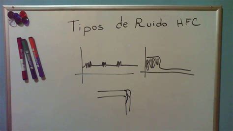 Tipos De Ruido HFC YouTube