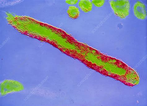 Coloured Tem Of Vibrio Cholerae Bacterium Stock Image B2200138 Science Photo Library