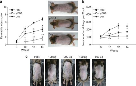 Oral Administration Of Poly γ Glutamate Ameliorates Atopic Dermatitis