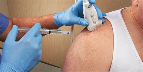 Pain Management Shoulder Injections All Star Pain Management And Regenerative Medicine