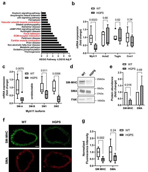 Reduced Smooth Muscle Myosin Heavy Chain Abundance In Hgps Aortas A Download Scientific