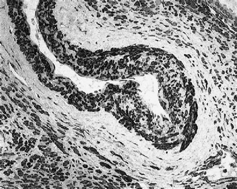 Smooth muscle differentiation of cellular changes in the vessel wall ...