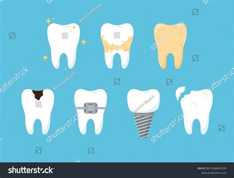 set tooth caries implant dentures care stock vector royalty
