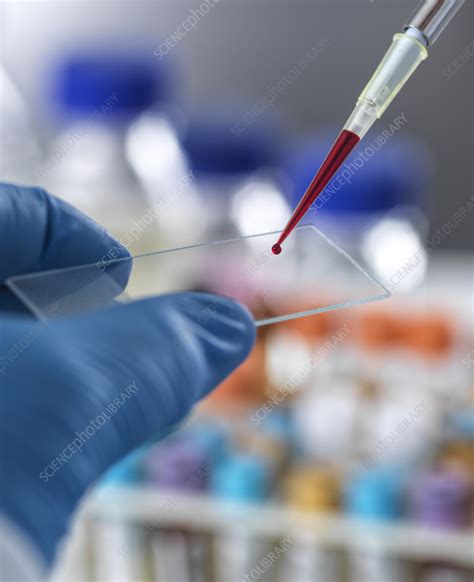 Blood Testing Stock Image F Science Photo Library