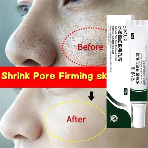 Salicylic Acid Pores Shrink Refining Cream Treatments Large Open Pore