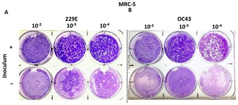 Improved Plaque Assay For Human Coronaviruses 229e And Oc43 Peerj