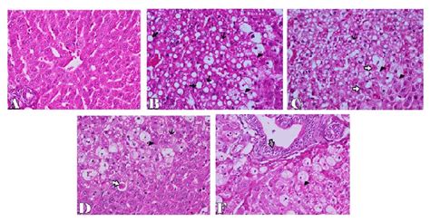 Liver Of Rabbit In Control Group Showing Normal Histological Structure