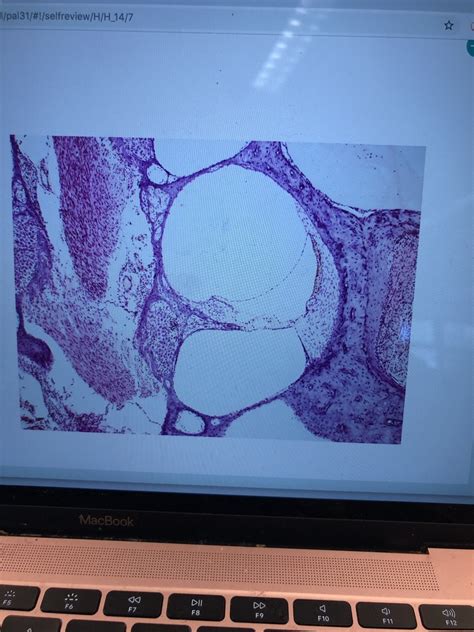 Cochlea Upclose Diagram Quizlet