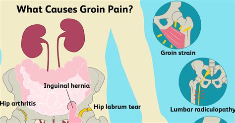 Groin Muscle Anatomy : groin - The Sports Physio : Groin muscles ...