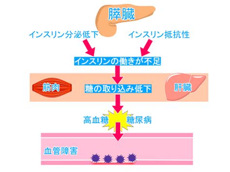 糖尿病について ① 南加瀬ファミリークリニック 川崎市幸区