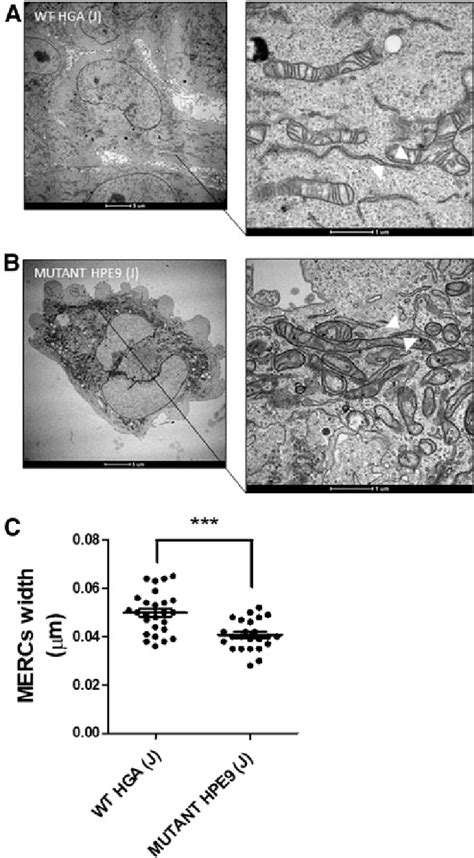 Tem Analysis Wt And Lhon Mutant 1778nd4 J The Width Of The