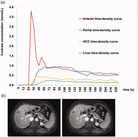 Dynamic Contrast Enhanced Magnetic Resonance Imaging Of A 51 Year Old Download Scientific