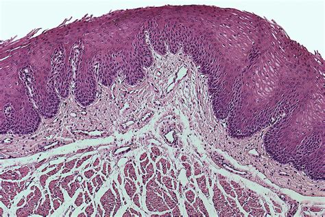 Stratified Squamous Epithelium Mucosa Photograph by Science Stock ...