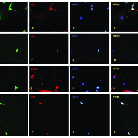 Conversion Of Sma And Control Fibroblasts To Motor Neurons With