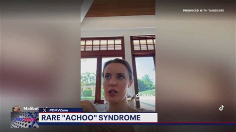 Achoo Syndrome Do You Have It Fox 5 Dc