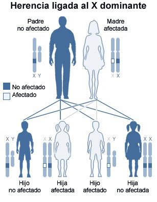 Biology Lovers Anomalias Relacionadas Con Los Cromosomas Sexuales