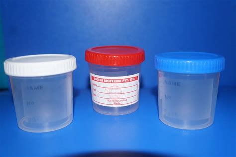 Laboratory Consumables Urine Sample Container Manufacturer From Mumbai