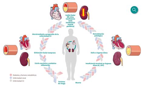 Cardiorrenal Es Abordaje Del Riesgo Cardiovascular En Tus Pacientes