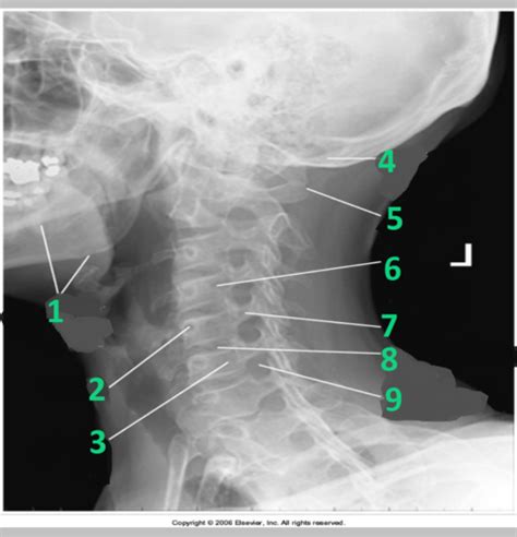 Oblique C Spine 1 Image Eval Exam 5 Diagram Quizlet