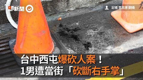 台中西屯爆砍人案！ 1男遭當街「砍斷右手掌」 播吧boba Ettoday新聞雲