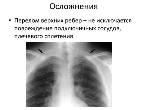 Повреждения грудной клетки - презентация онлайн