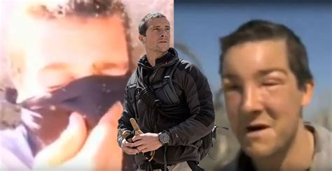 Watch: Bear Grylls rushes for aid after savage allergic reaction to bee sting - Extra.ie