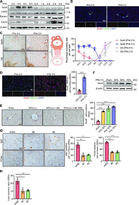 Sox9 HNF4α hepatocytes are involved in liver regeneration after