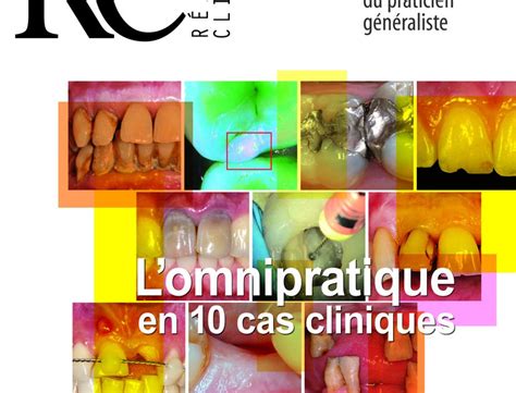 Lomnipratique En Cas Cliniques L Information Dentaire