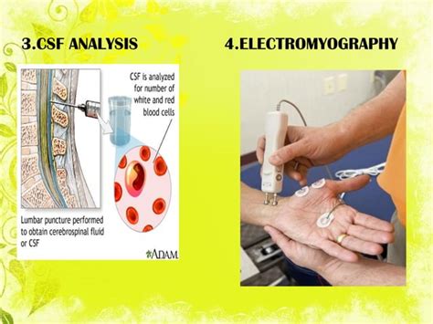 GB SYNDROME.pptx ddaxxdvdvsdvsdvevvergbrg | PPT