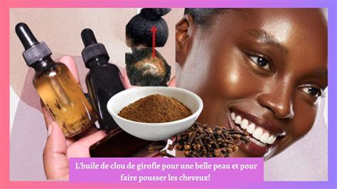 Comment Faire Lhuile De Clou De Girofle Pour Une Belle Peau Et Pour