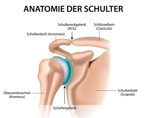 Was Ist Eine ACG Arthrose