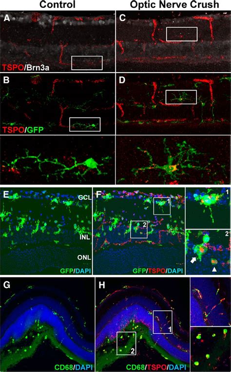 Macroglia Microglia Interactions Via Tspo Signaling Regulates