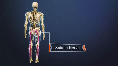 The Essentials Of Sciatic Nerve Pain Patterns Spine Health