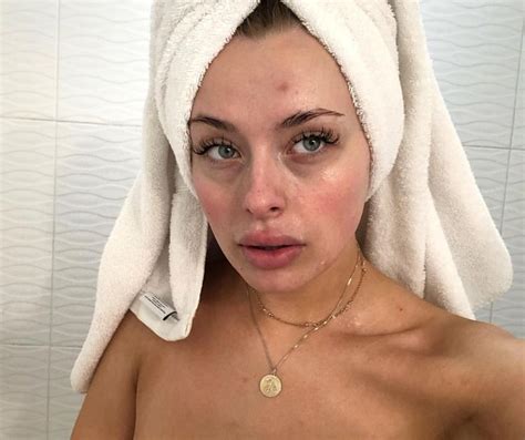 1882k Likes 3876 Comments Corinna Kopf Corinnakopf On Instagram “dark Circles