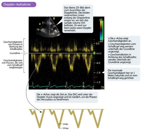 Doppler Effekt Und Doppler Echokardiographie EKG ECHO