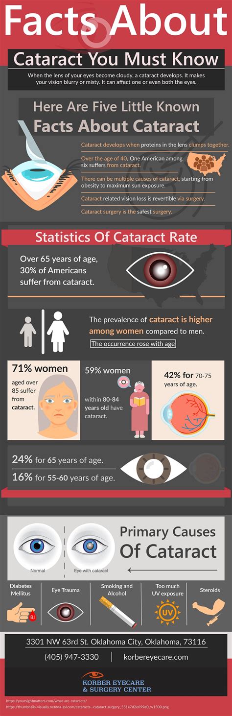 Facts About Cataract You Must Know Infographic