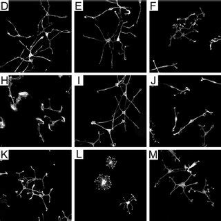 Fig. S5. Lamellipodia formation in the β-catenin LOF and GOF primary ...