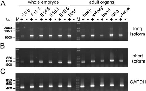 Expression Of Protocadherin‐1 Pcdh1 During Mouse Development Redies