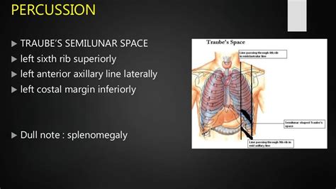 Splenomegaly : causes , clinical approach and examination