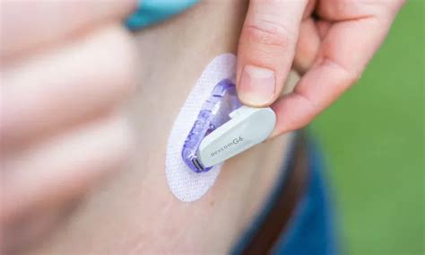 Dexcom G Placement Best Spots On Your Body To Wear It