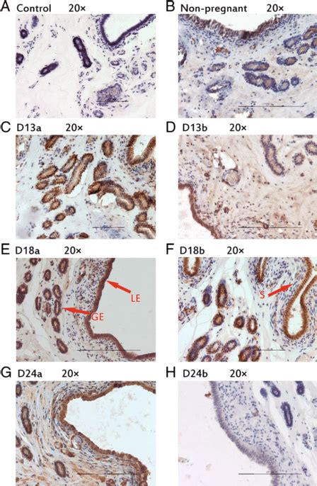 Immunhistochemical Localization Of Ihh In Pig Uterus Ge Glandular