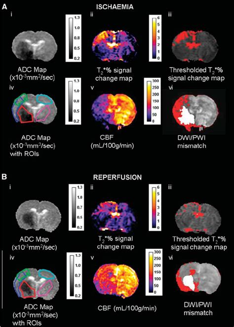 A Ischemia Scan Series And B Post Reperfusion Scan Series With