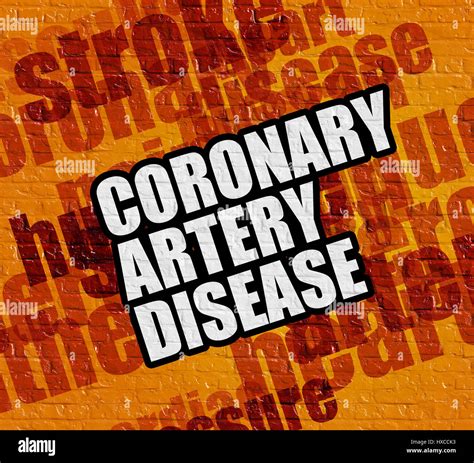 Coronary Arteries Hi Res Stock Photography And Images Alamy