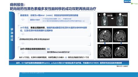 大咖谈 Braf突变黑色素瘤靶向治疗耐药应对策略 Medscicn