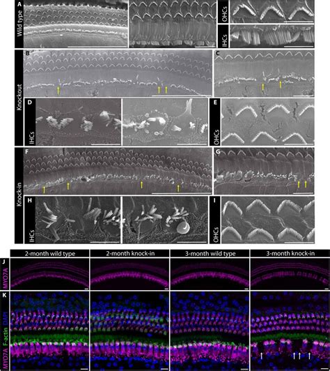 Morphology Of Ko And Ki Mouse Cochlear Hair Cells Sem Of Month Old