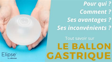 Tout Savoir Sur Le Ballon Gastrique YouTube