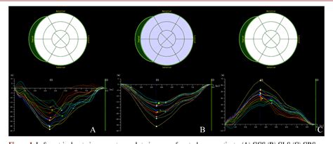 Figure 1 From Evaluation Of Left Ventricular Function In Diabetes