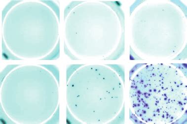 Representative Image For Enzyme Linked Immunospot Elispot Responses